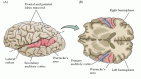 Figure 13.15. The human auditory cortical areas related to processing speech sounds.