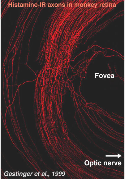 eye diagram fovea. area temporal to the fovea