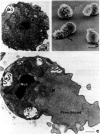 Figure 2. (a) Transmission electron micrograph of a budded spermatid containing one fused membranous organelle (MO) in the upper left corner and one labeled, unfused MO.