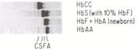 Figure 151.2. A standard hemoglobin electrophoresis (cellulose acetate, pH 8.