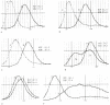 Figure 152.1. Red cell histograms in various conditions.