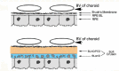 Figure 13. . Schematic images depicting the choroid-RPE-retina interface in a normal retina and an AMD interface.