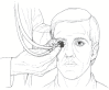 Figure 18.1. Technique for orbital auscultation.