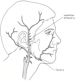 Figure 18.2. Arrows indicate points of manual compression of the right superficial temporal and facial arteries.