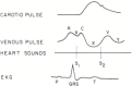 Figure 19.1. Timing of the jugular venous pulse (JVP) is displayed in relation to the carotid arterial tracing, first (S1) and second (S2) heart sounds, and the electrocardiogram (ECG).