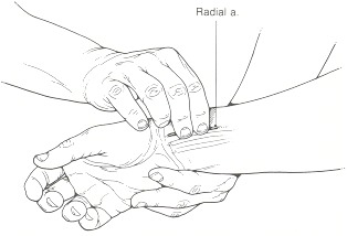 Figure 30.2. Radial artery.