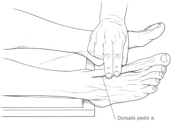 Figure 30.7. Dorsalis pedis artery.