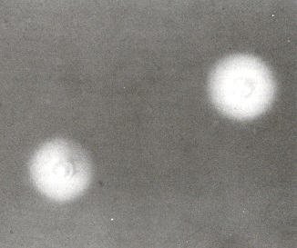 Figure 74.2. India ink preparation of cerebrospinal fluid showing two Cryptococcus neoformans cells.