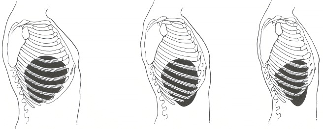 Figure 94.2. Lateral views of the liver for different body types.