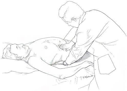 Figure 94.3. Bimanual technique for palpation of liver.