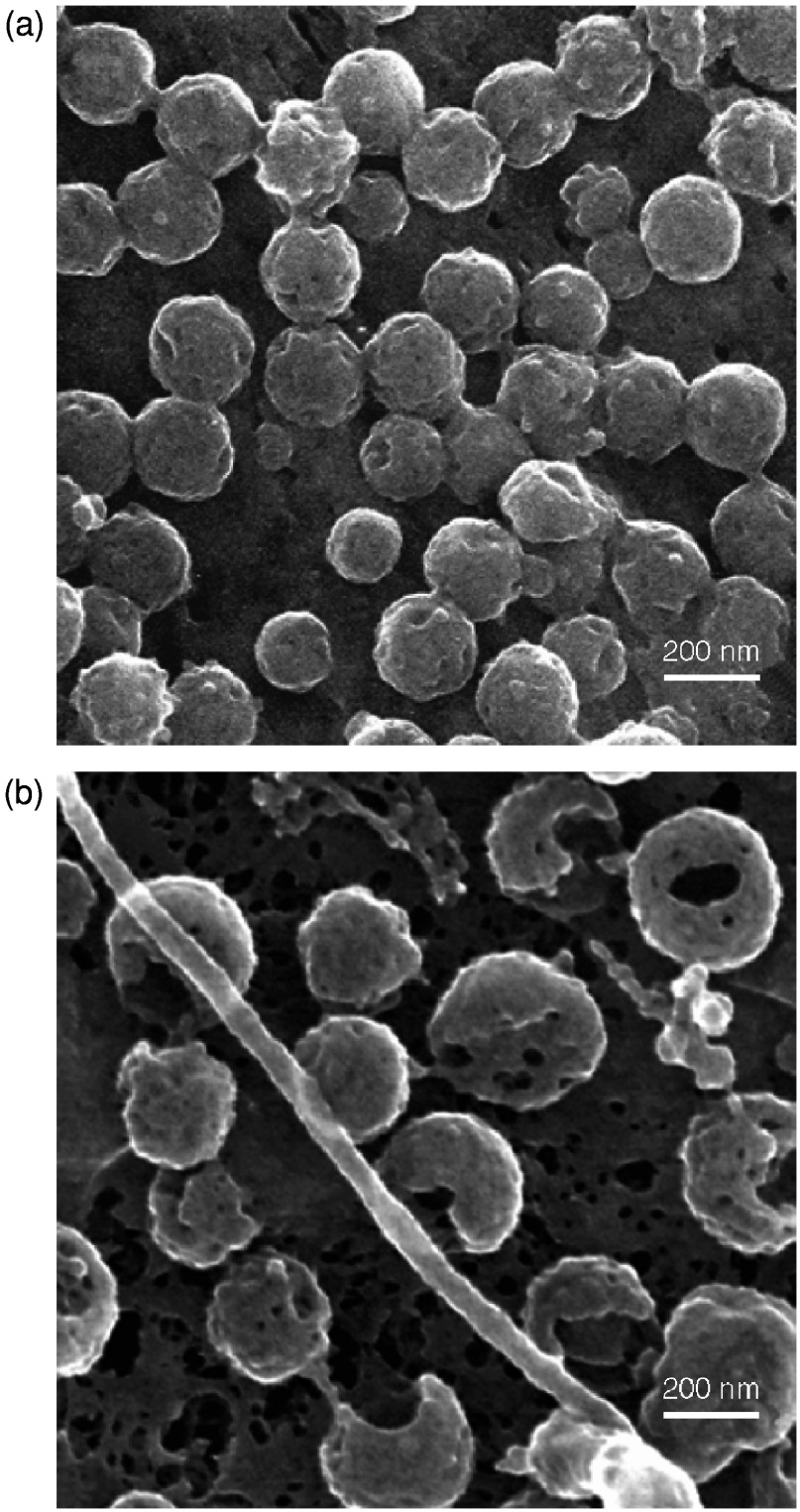 Fig. 7.2. Scanning electron micrographs of HSV -1 and VZV.
