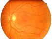 Figure 1. . Normal funduscopic examination of a human eye.