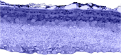 Figure 6. . Toluidine blue stain of light damage albino mouse retina.