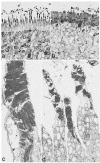 Figure 11. . Light (a, b) and Electron micrographs (c, d) of cone photoreceptors in the foveal region of retina of a patient with autosomal dominant retinitis pigmentosa.