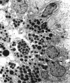 Figure 12. . Electron micrograph of a portion of bone corpuscular pigmentation.