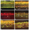 Figure 14. . Normal and retinitis pigmentosa (RP) human retinas after immunofluorescence labeling.