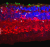 Figure 31. . Maximal projection image of PKC (red), Rho 1D4 (green), and DAPI (blue) in the Tg P347L rabbit retina.