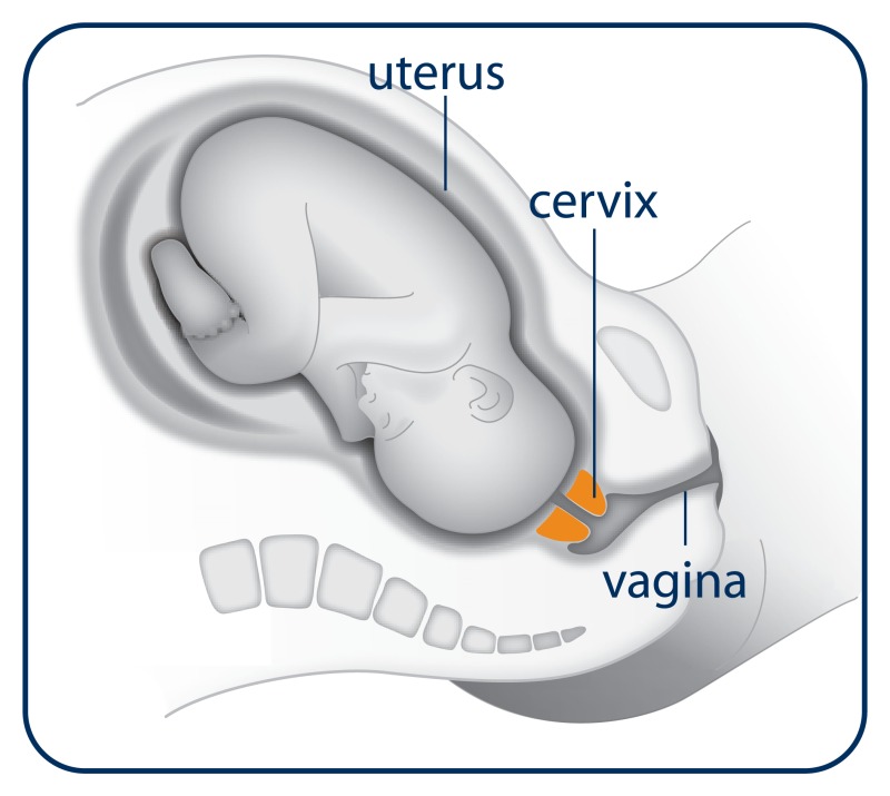 Position of baby during labor.