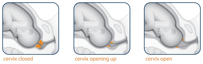 Cervix opening up during labor.