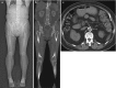 Fig. 20.3. Scout image of the abdomen and lower extremities is used for planning the CT scan (a).