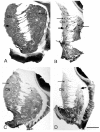 Figure 1.. Comparison of the patterns of GABAA receptor β, subunit immunostaining in the striatum of a normal case (A) and three HD cases with predominant receptor loss in the matrix compartment and preservation of striosomes (B), in the striosomes compartment (C), or in both striatal compartments (D).