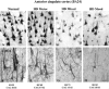 Figure 2.. High power photomicrographs illustrating the pyramidal neurons in layer III in BA24 of the anterior cingulate cortex of normal (A,E) and Huntington's disease (B-D, F-H) cases with "mainly motor" (B,F), "mixed" (C,G) and "mainly mood" (D,H) symptoms.