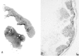 Figure 15-5. Necrosis of rabbit ileal mucosa 4 hours after introduction of a toxigenic cell-free culture filtrate of B cereus.