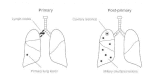 Figure 33-4. Radiologic differences between primary and post-primary tuberculosis.