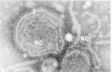 Figure 41-2. Fragments of flexible helical nucleocapsids (NC) of Sendai virus, a paramyxovirus, are seen either within the protective envelope (E) or free, after rupture of the envelope.