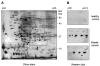 FIGURE 2.13. Western blot showing the presence of protein antigen-antibody reactions as potential markers from patients with breast cancer but not from healthy controls.