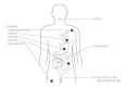 Figure 24-1. Pathophysiology of cholera.