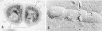 Figure 2-5. (A) Electron micrograph of a thin section of the Gram-positive M.