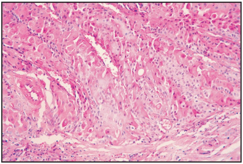 Fig. 4.29. Hepatoid gland adenoma.