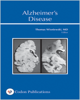Cover of Alzheimer’s Disease