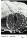 Figure 21-92. Formation of the neural tube.