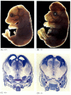  Figura 6.28. Interruzione del normale sviluppo cerebrale bloccando l'apoptosi.