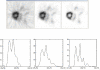 FIGURE 7.7. Images of mouse heart illustrate improvements due to image reconstruction: (left) filtered backprojection algorithm, (middle) iterative ordered-set expectation maximization (OSEM) algorithm, (right) OSEM with detector response modeling.