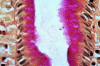 Figure 1. Example of the El-Zimaity dual stain of gastric mucosa (26).