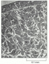 Figure 19-33. Cells surrounded by spaces filled with extracellular matrix.