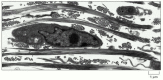 Figure 19-44. Fibroblast surrounded by collagen fibrils in the connective tissue of embryonic chick skin.