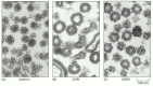 Figure 13-4. Electron micrograph of clathrin-coated, COPI-coated, and COPII-coated vesicles.