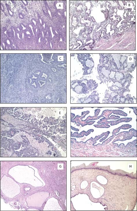 Figure 5, Endometrial histology: - StemBook - NCBI Bookshelf