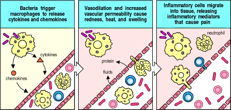 Figure 1.12. Bacterial infection triggers an inflammatory response.