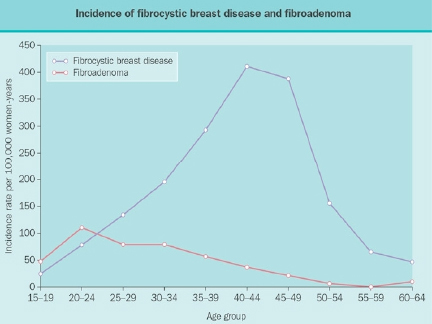 Benign Breast Disease in Women - Endotext - NCBI Bookshelf