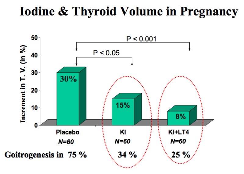 Figure 14-3. Randomized clinical trial with placebo versus KI (100 µg iodine/day) or KI + l-T4 (100 µg iodine/day and 100 µg T4/day) given during pregnancy in women with moderate iodine deficiency and laboratory features of thyroidal stimulation.