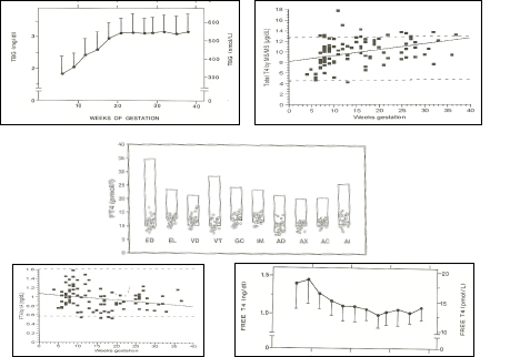 Figure 14-8 Upper left panel: pattern of changes in serum TBG concentrations (mean + sd) in 606 normal pregnant women ( Ref 1). Upper right panel: pattern of changes in serum total T4 concentrations (individual results) in 98 normal pregnancies ( Ref 86). Middle panel: free T4 measurements in 29 women in the 9th month of gestation, using equilibrium dialysis (ED), and 9 different immunoassays (EL: Elecsys; VD: Vidas; VT: Vitros ECi; GC: Gamma-Coat; IM: Immunotech; AD: Advantage; AX: AxSYM; AC: ACS: 180; AI: AIA Pack). The boxes show the non-pregnant upper and lower reference intervals. The percentages given in the upper part of the figure show the mean decrement (in percent) of serum free T4 values compared with the mean free T4 reference value for non-pregnant subjects, provided by the manufacturer. It can be seen that free T4 values were decreased by 40% when measured by ED, and by 17-34% depending on the immunoassay employed . Lower left panel: pattern of changes in serum free T4 concentrations (individual results) in 98 normal pregnancies in the USA, with an adequate iodine intake (Ref 86). Lower right panel: pattern of changes in serum free T4