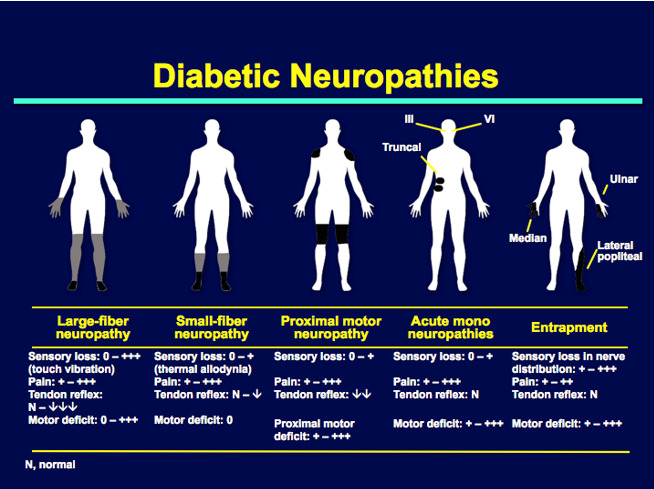 Diabetic Neuropathies - Endotext - NCBI Bookshelf