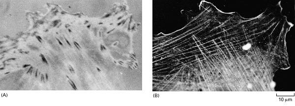 Figure 16-74. The relation between focal contacts and stress fibers in cultured fibroblasts.