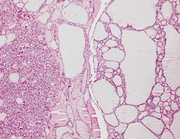 Image tyd-nodules_31-2b.jpg