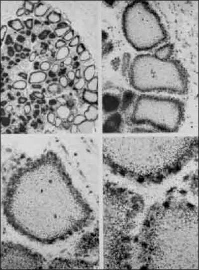 Fig. 2-3. Radioautographs of rat thyroid sections.